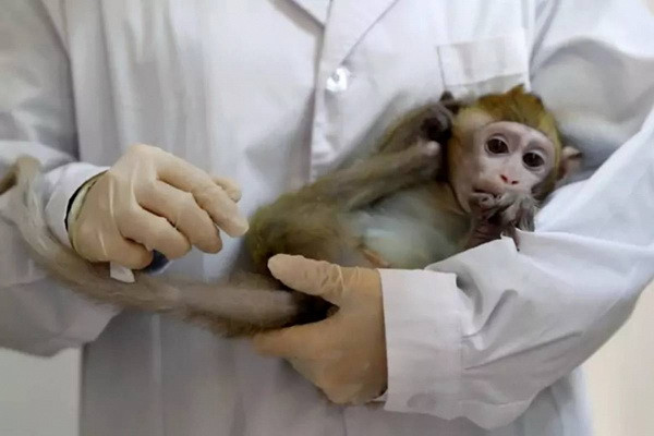 US records first death of monkeypox case