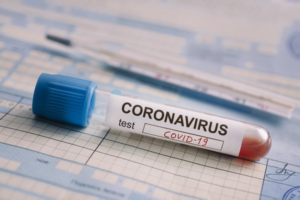 COVID-19: 31 more people diagnosed with disease in Uzbekistan