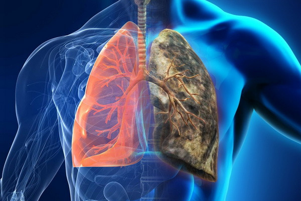 FCI expert: vaping can cause a new wave of cancer
