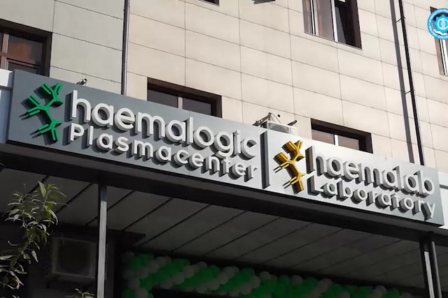 Тошкентда плазма маркази очилди